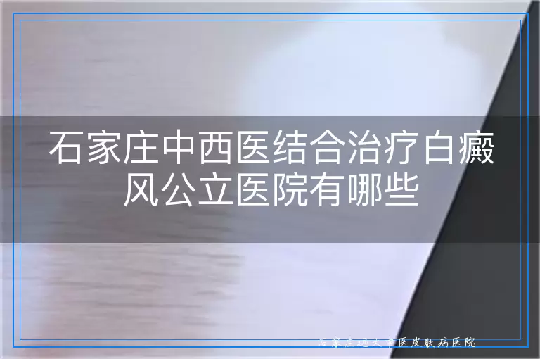 石家庄中西医结合治疗白癜风公立医院有哪些