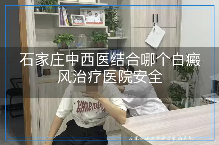 石家庄中西医结合哪个白癜风治疗医院安全