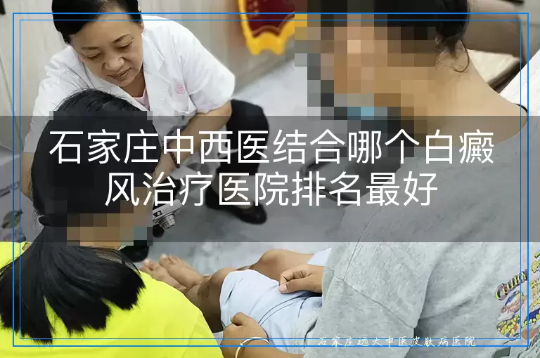 石家庄中西医结合哪个白癜风治疗医院排名最好