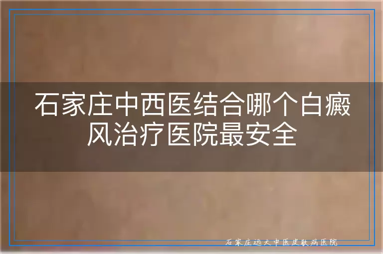 石家庄中西医结合哪个白癜风治疗医院最安全