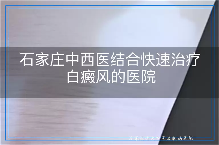 石家庄中西医结合快速治疗白癜风的医院