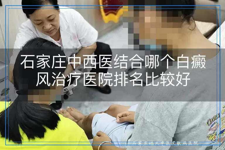 石家庄中西医结合哪个白癜风治疗医院排名比较好