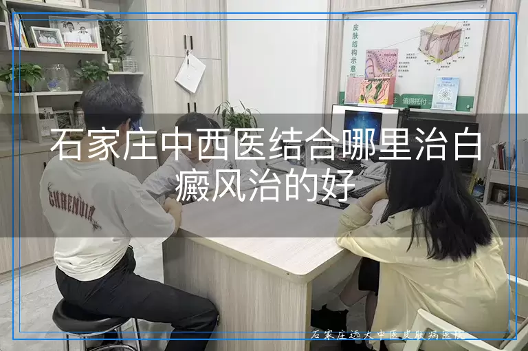 石家庄中西医结合哪里治白癜风治的好