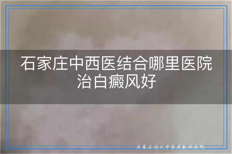 石家庄中西医结合哪里医院治白癜风好