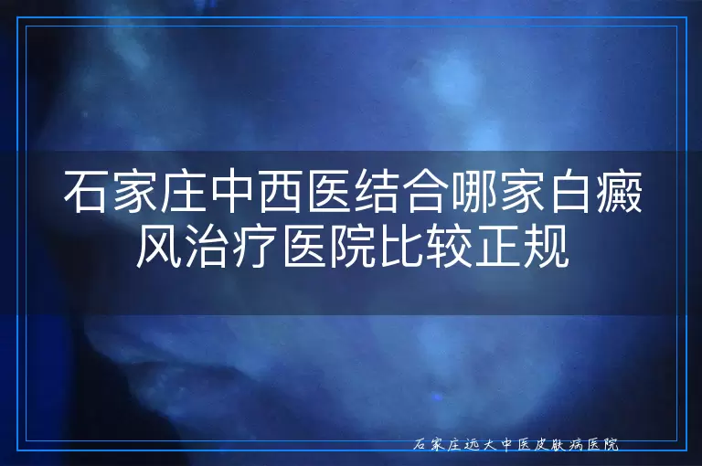 石家庄中西医结合哪家白癜风治疗医院比较正规