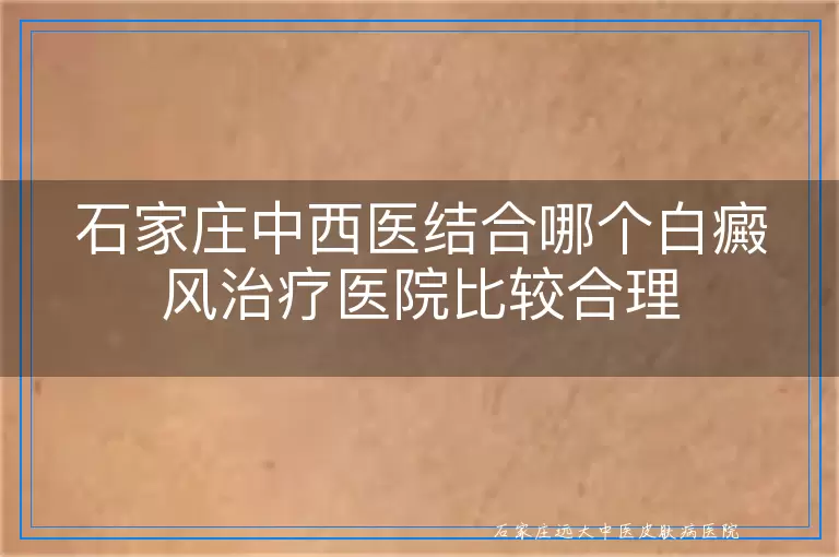 石家庄中西医结合哪个白癜风治疗医院比较合理