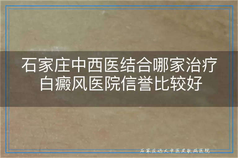 石家庄中西医结合哪家治疗白癜风医院信誉比较好