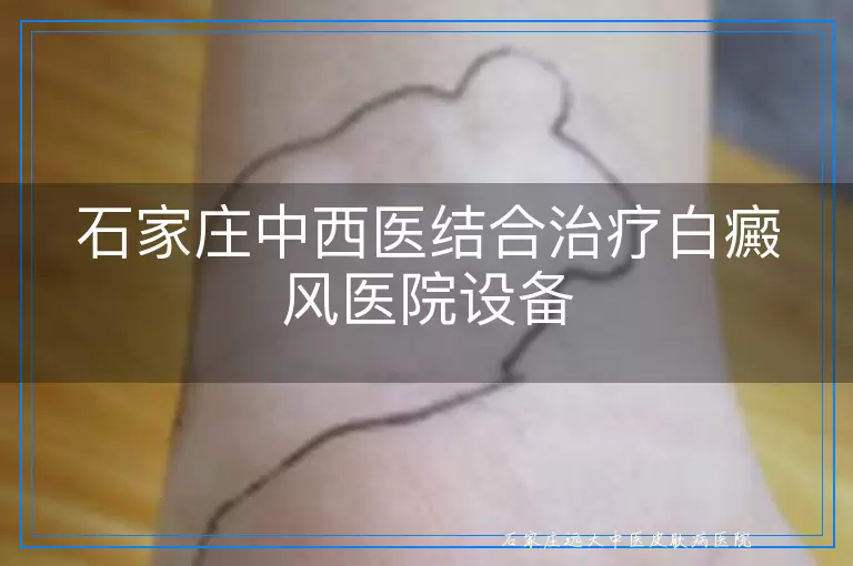 石家庄中西医结合治疗白癜风医院设备