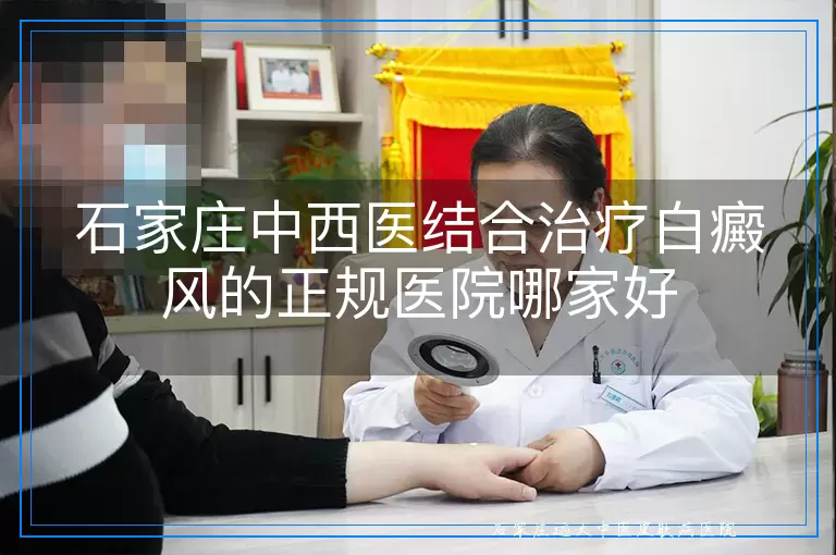 石家庄中西医结合治疗白癜风的正规医院哪家好
