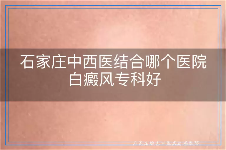 石家庄中西医结合哪个医院白癜风专科好