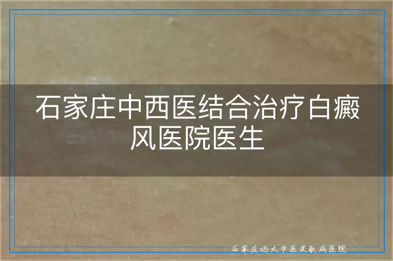 石家庄中西医结合治疗白癜风医院医生