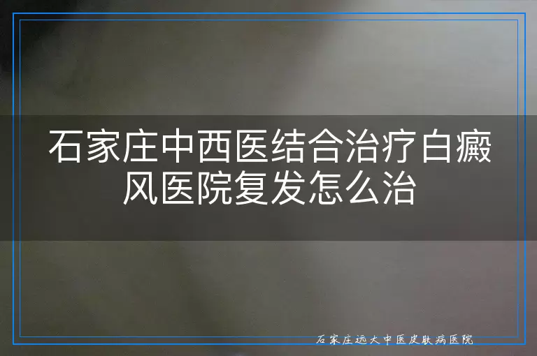 石家庄中西医结合治疗白癜风医院复发怎么治