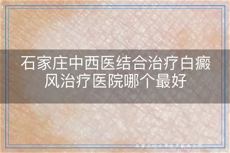 石家庄中西医结合治疗白癜风治疗医院哪个最好
