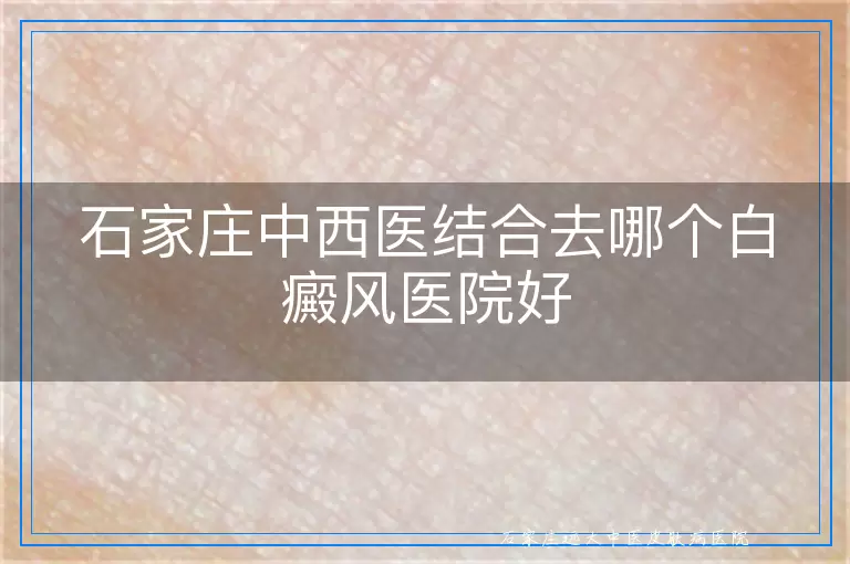 石家庄中西医结合去哪个白癜风医院好