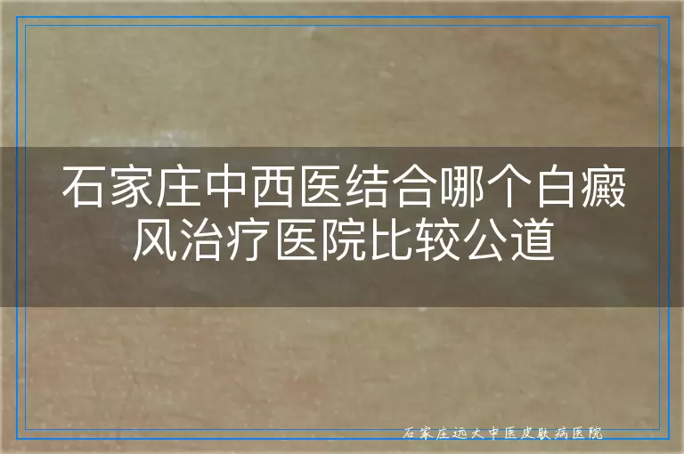 石家庄中西医结合哪个白癜风治疗医院比较公道