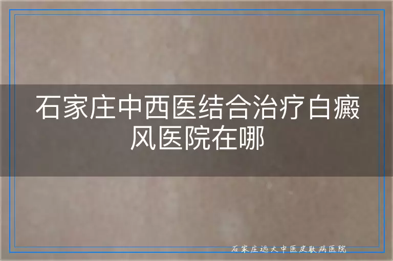 石家庄中西医结合治疗白癜风医院在哪