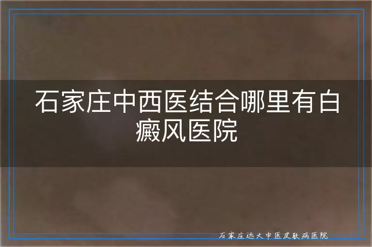石家庄中西医结合哪里有白癜风医院