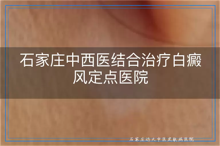 石家庄中西医结合治疗白癜风定点医院