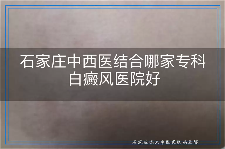 石家庄中西医结合哪家专科白癜风医院好