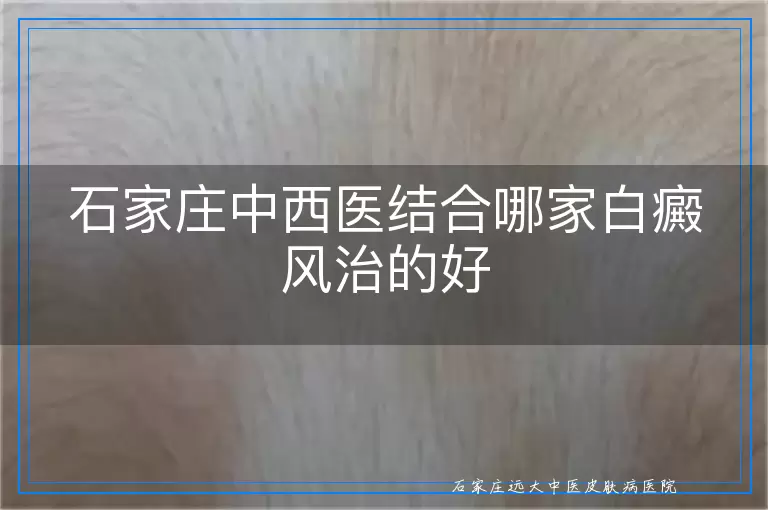 石家庄中西医结合哪家白癜风治的好
