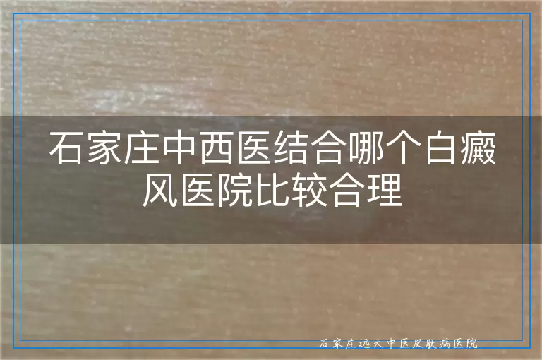 石家庄中西医结合哪个白癜风医院比较合理