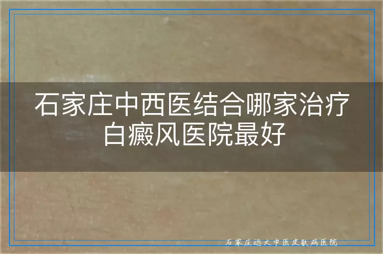 石家庄中西医结合哪家治疗白癜风医院最好