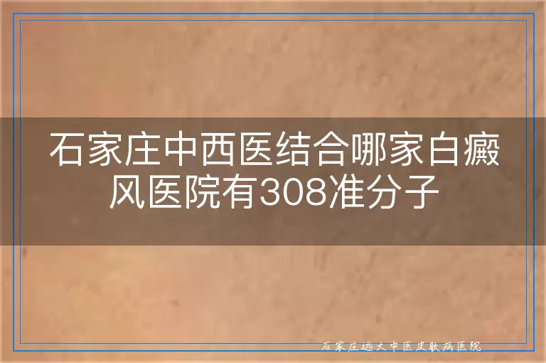石家庄中西医结合哪家白癜风医院有308准分子