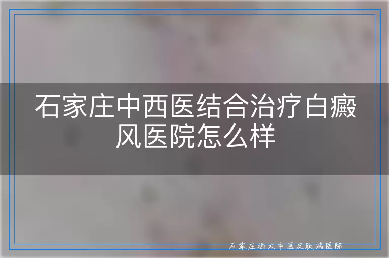 石家庄中西医结合治疗白癜风医院怎么样
