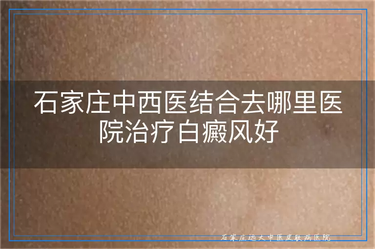 石家庄中西医结合去哪里医院治疗白癜风好