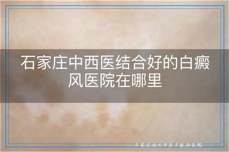 石家庄中西医结合好的白癜风医院在哪里