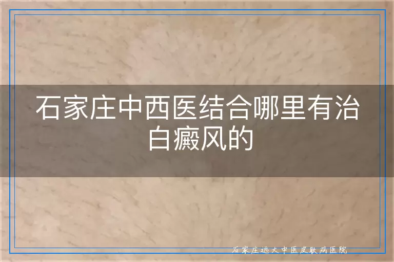 石家庄中西医结合哪里有治白癜风的