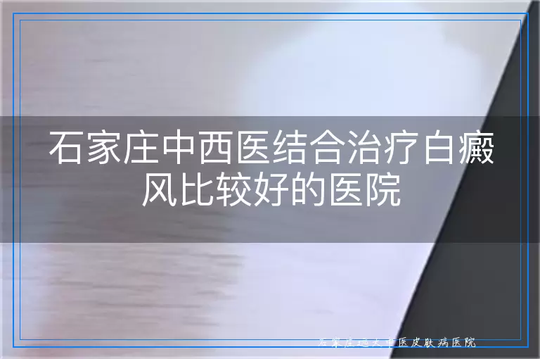 石家庄中西医结合治疗白癜风比较好的医院