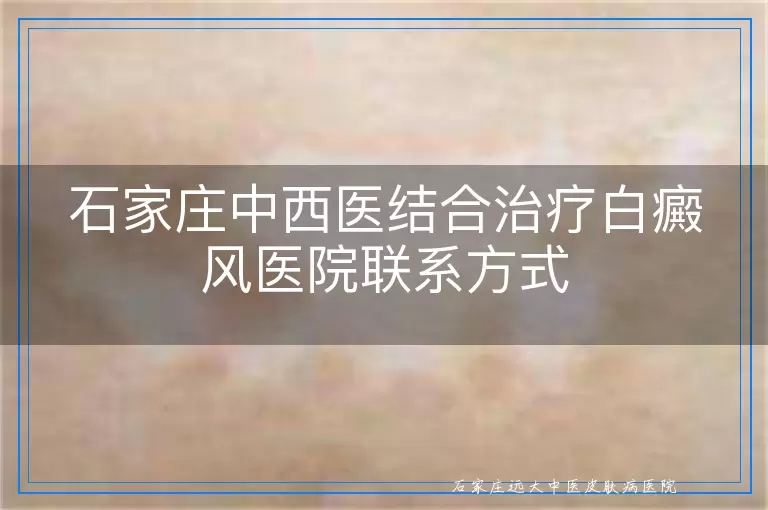 石家庄中西医结合治疗白癜风医院联系方式