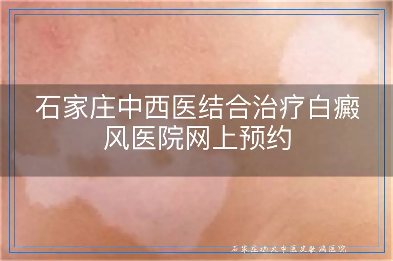 石家庄中西医结合治疗白癜风医院网上预约