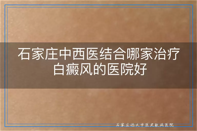 石家庄中西医结合哪家治疗白癜风的医院好