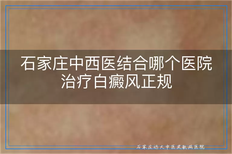 石家庄中西医结合哪个医院治疗白癜风正规