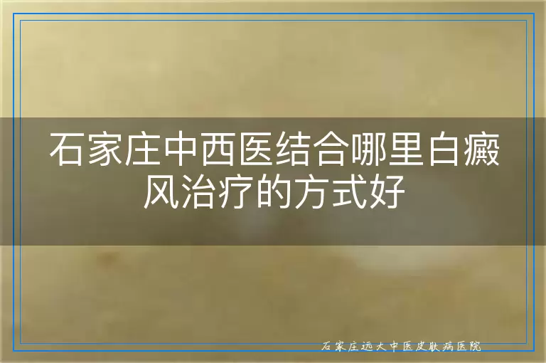 石家庄中西医结合哪里白癜风治疗的方式好
