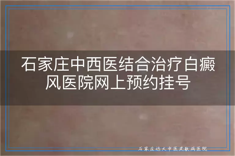 石家庄中西医结合治疗白癜风医院网上预约挂号