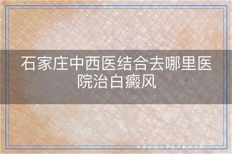 石家庄中西医结合去哪里医院治白癜风