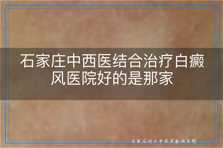 石家庄中西医结合治疗白癜风医院好的是那家