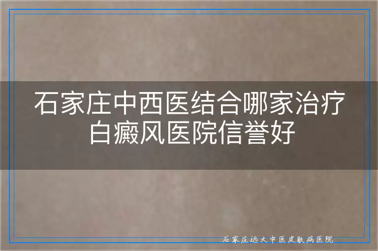 石家庄中西医结合哪家治疗白癜风医院信誉好