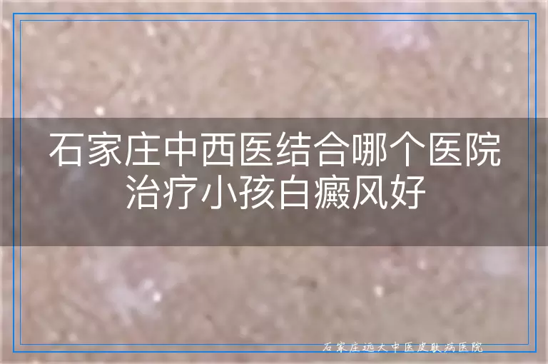 石家庄中西医结合哪个医院治疗小孩白癜风好