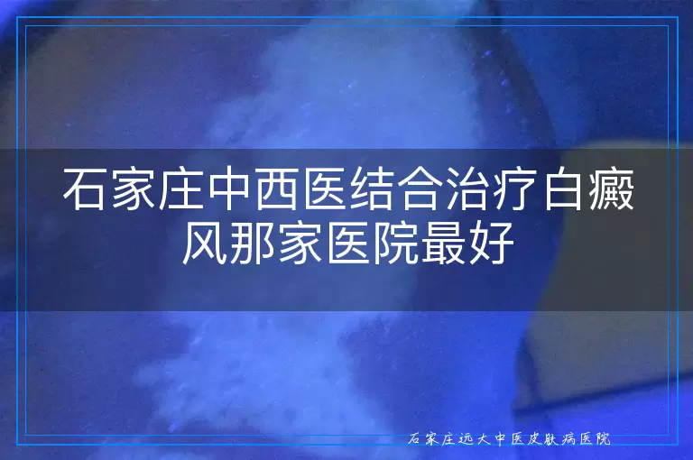 石家庄中西医结合治疗白癜风那家医院最好