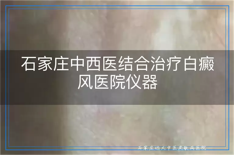 石家庄中西医结合治疗白癜风医院仪器