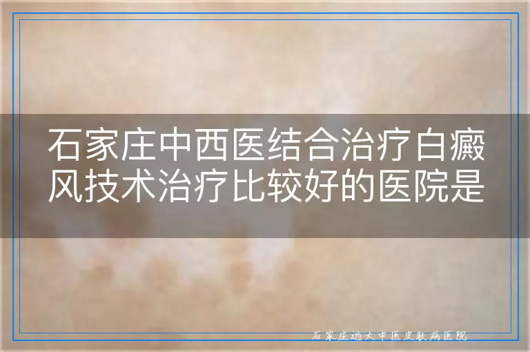 石家庄中西医结合治疗白癜风技术治疗比较好的医院是哪个