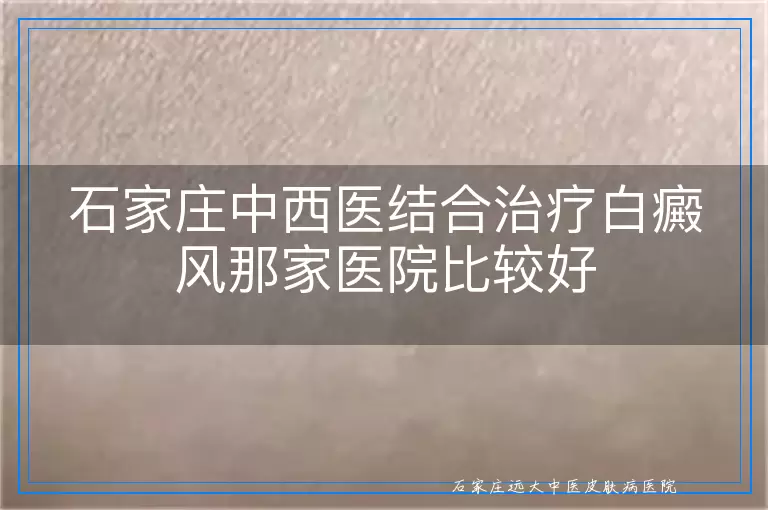 石家庄中西医结合治疗白癜风那家医院比较好