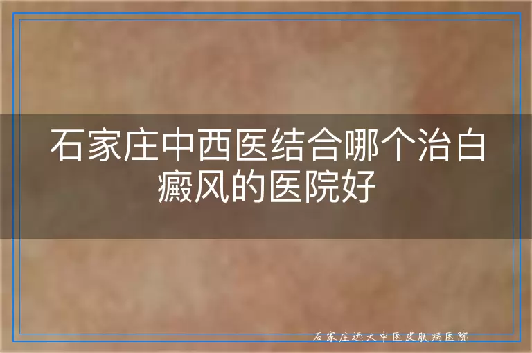 石家庄中西医结合哪个治白癜风的医院好