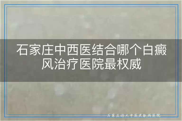 石家庄中西医结合哪个白癜风治疗医院最权威