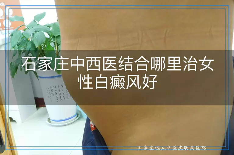 石家庄中西医结合哪里治女性白癜风好