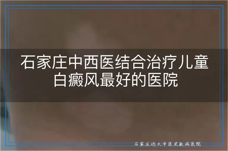 石家庄中西医结合治疗儿童白癜风最好的医院